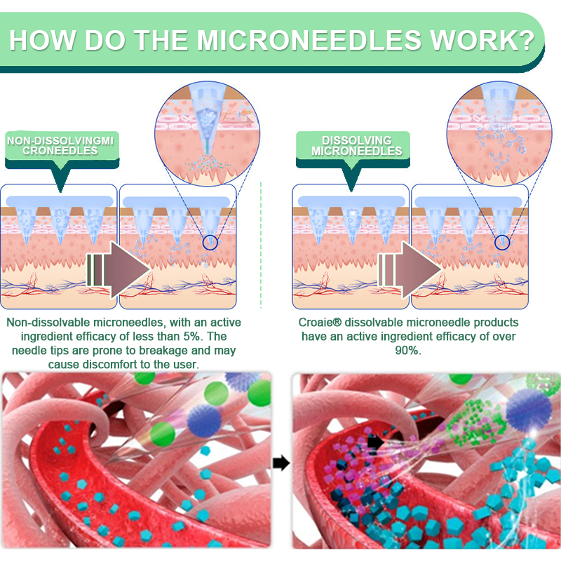 【Last Day Promotion 60% OFF👨⚕️】Croaie® SIX IN-ONE NIDDK-Tirzepatide Health NANO MICRONEEDLE PATCH 👨⚕️(Zero Pain, 24/7 Release | Lose 20 lbs FAST | 90% Sugar Drop | ) 🎁